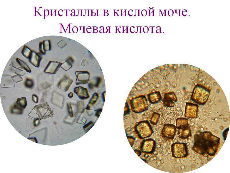 Мочекаменная болезнь у кошек
